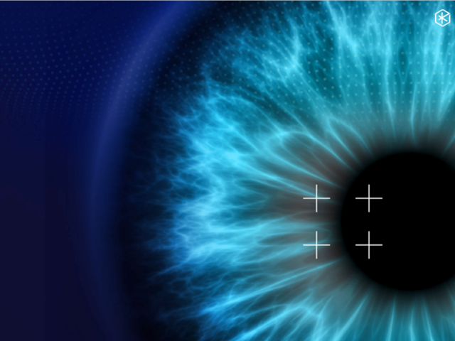 Recent clinical data shows the FemtoMatrix.® is faster than Phaco.